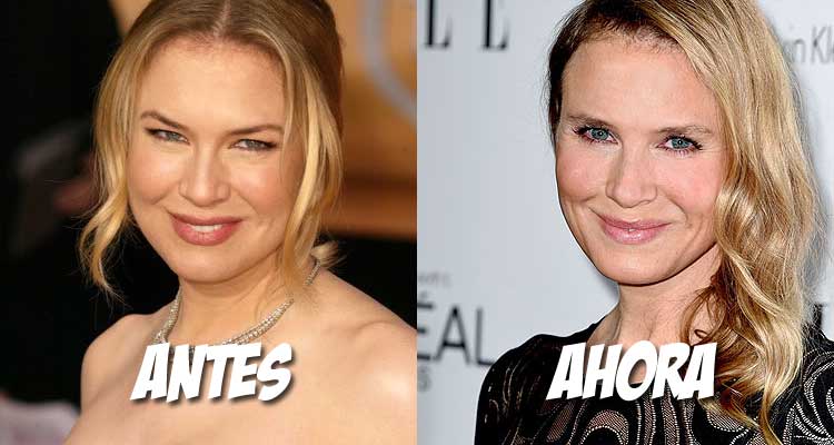 renée zellweger se cambia la cara a golpe de bisturí